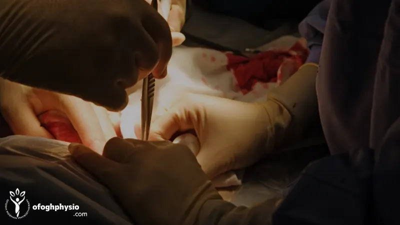 جراحة القرص القطني في الحالات الحادة